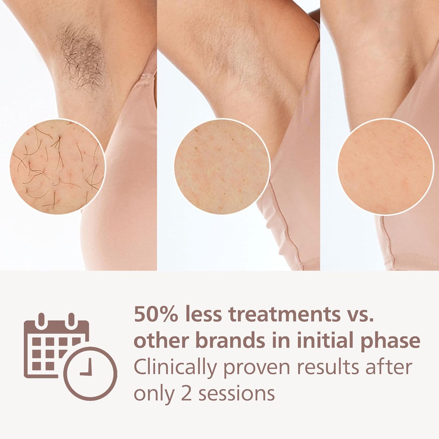Philips Lumea 9900 Series, IPL Hair Removal Device, Laser Hair Removal Alternative, SenseIQ and SkinAI Technology, 4 Attachments for Body, Face, Bikini and Underarms, Corded & Cordless Use, BRI951/01